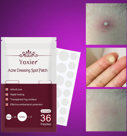 Invisible Acne Pimple Patches - Hydrocolloid Spot Treatment Stickers