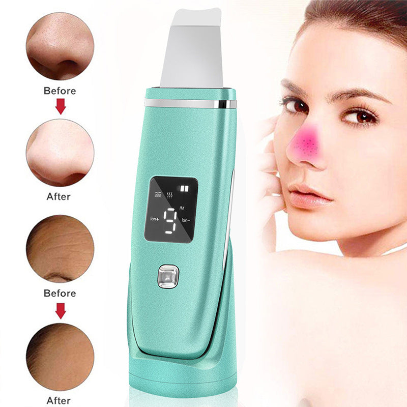 Ultrasonic Skin Scrubber - Deep Pore Cleansing & Exfoliation Tool
